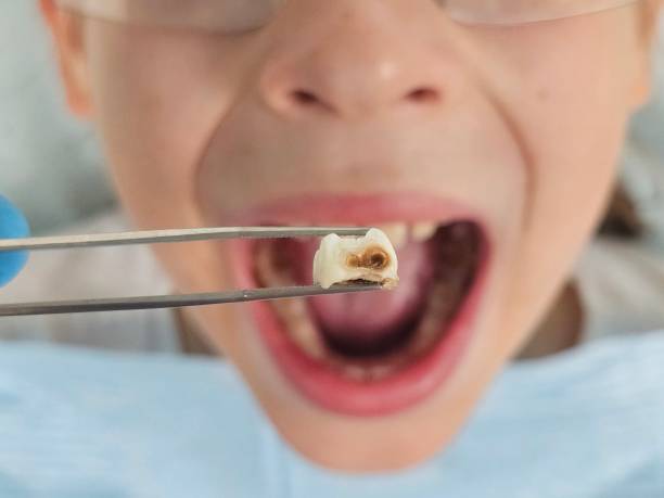 Best Emergency Care for Gum Disease in Clinton, KY