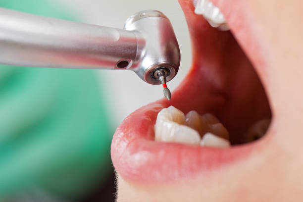 Best Walk-In Emergency Dental Services in Clinton, KY